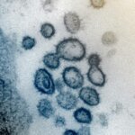 Ilmuwan China Temukan Mutasi Langka Virus Corona SARS-CoV-2 yang Lebih Mematikan