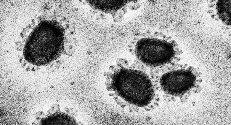 Tipe Virus Corona di Indonesia Berbeda? Ini Alasannya