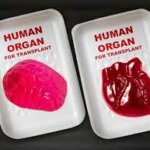 Terungkap Jaringan Praktik Jual Beli Organ Ilegal di Tiongkok