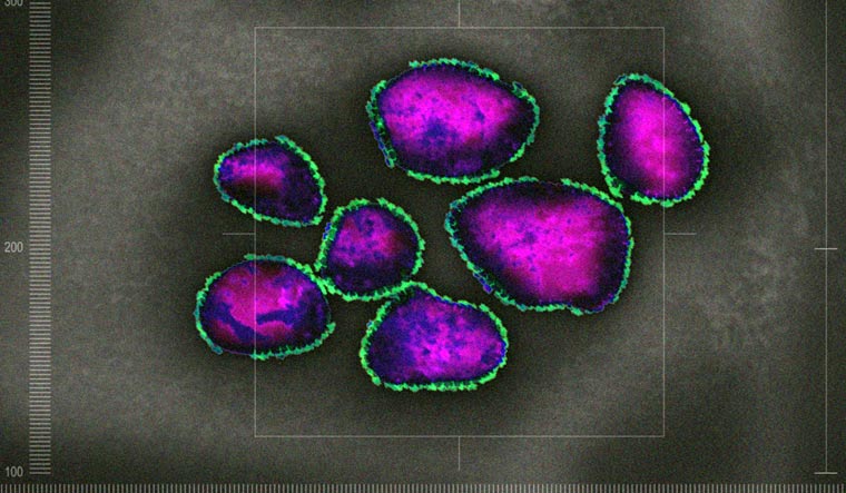 P681H, Varian Virus Baru Muncul di Nigeria